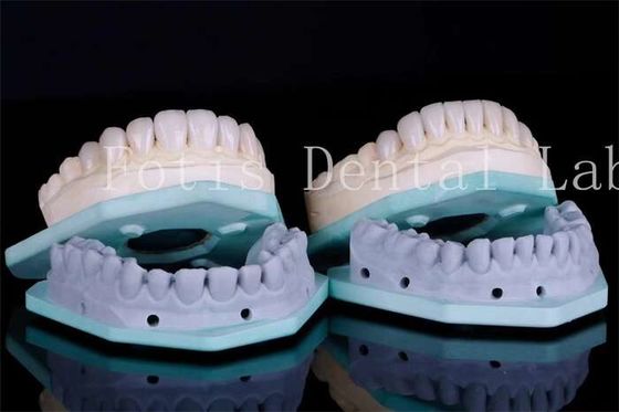 Carillas dentales resistentes a las manchas Carillas de clínica dental 0.3mm-0.5mm de espesor