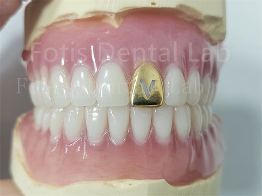 Prótese dental acrílica con dientes naturales