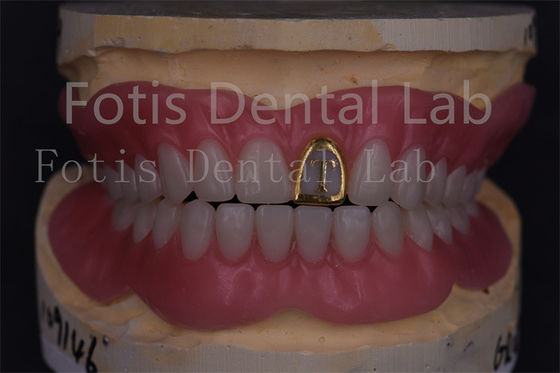 Técnicos profesionales Dentadura completa acrílica Dentes falsos Prótesis de precisión
