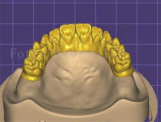 Diseño dental innovador para mejorar la productividad y la rentabilidad