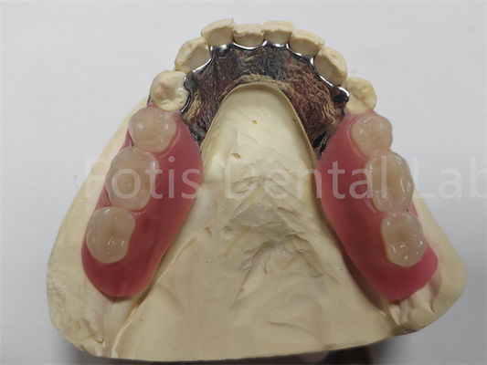 OEM Flexible Dentadura parcial extraíble fácil de limpiar / mantener