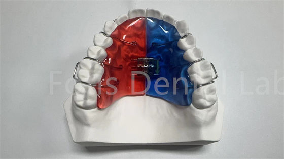 Extensor de ortodoncia individual para la corrección y mejora dental