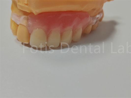 Certificación FDA/ISO TCS Valplast Dentaduras flexibles fáciles de limpiar y ajustar