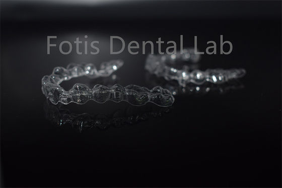Dientes extraíbles alineadores invisibles aparatos dentales invisibles personalización