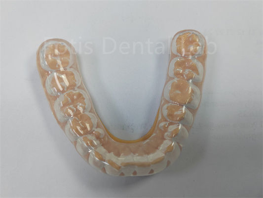 Guardia nocturna profesional dura y suave Mantenga sus dientes sanos Protección dental