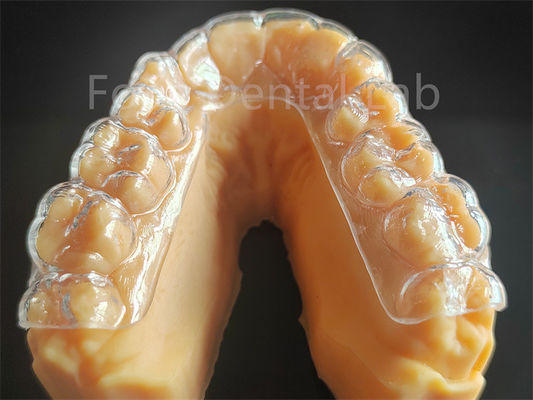 Protector dental duro a medida Protector bucal duro para rechinar dientes