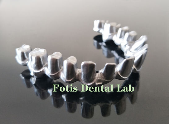 Implantes dentales de arco completo confiable con 4 implantes dentales con cigonia de titanio