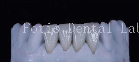 Dientes delgados de chapa de laminado sintético de 0,3-0,5 mm de espesor