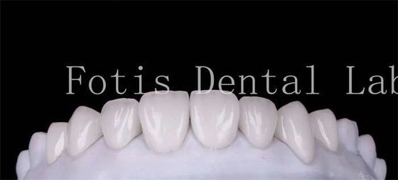 Polishing Finishing Cosmetic Dental Veneer cubre para una sonrisa hermosa