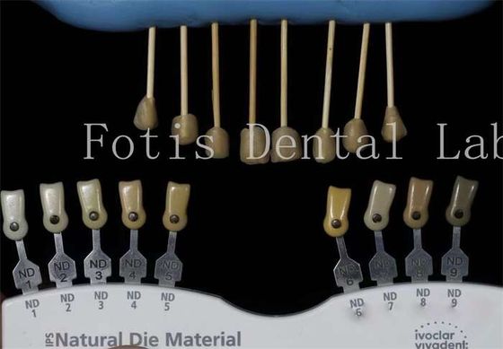 Carillas de laboratorio dentales de 0,3-0,5 mm de espesor