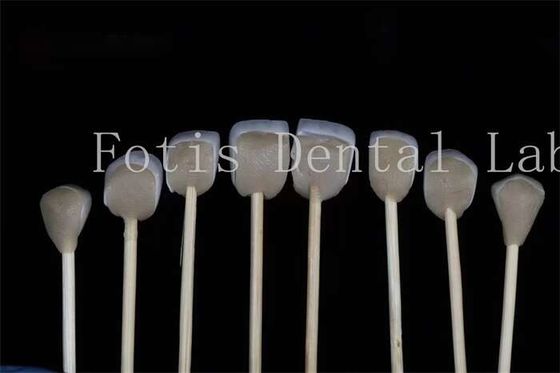 Fabricación de revestimientos laminados de laboratorio dental personalizados Compatibilidad con diversos preparados dentales