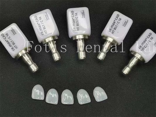 Las carillas dentales artificiales de alta translucidez son ideales para la belleza de la odontología cosmética