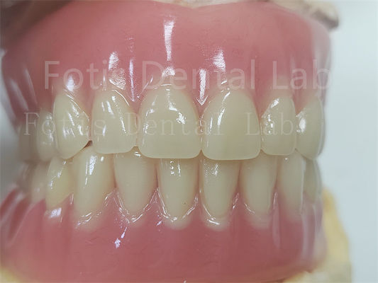 Confort Dentadura de acrílico para prótesis dentales precisas
