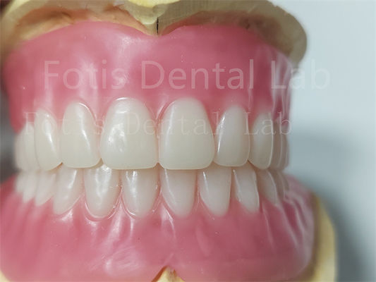 Color natural duradero Dentadura de acrílico completo Personalización inodora