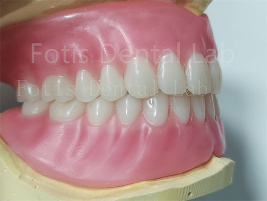 Dentes Ivoclares Prótese dental acrílica completa Fácil de limpiar Alta durabilidad