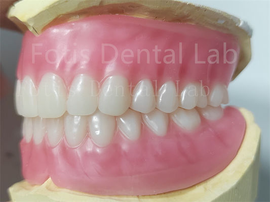 OEM Dentadura acrílica completa superior e inferior Resistencia a las manchas Color natural