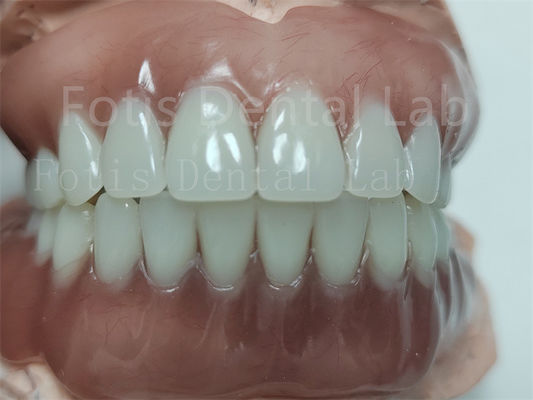 Dentadura completa de acrílico con dientes de ivoclar