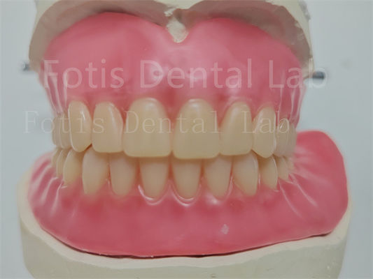 Dentadura de acrílico personalizada con dientes Ivoclar fácil de usar