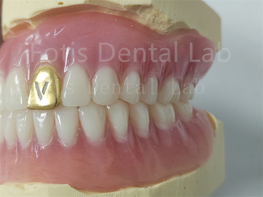 Dentes de acrílico con dentadura completa personalizable Resistente a olores Confort Fit