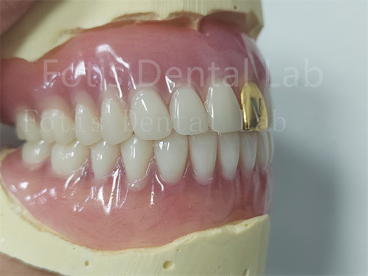 Estética Conjunto completo de prótesis dental acrílica Adaptable fácil de limpiar