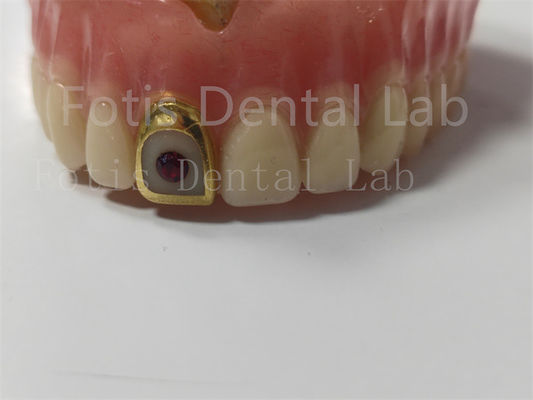 Dentadura de acrílico para profesionales Resistente a manchas y olores