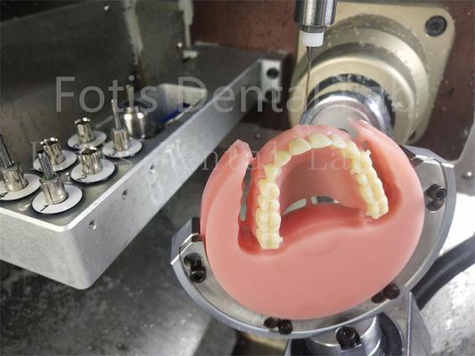 Ivoclar de color natural con dentadura de acrílico completo confort ajuste de prótesis con estética
