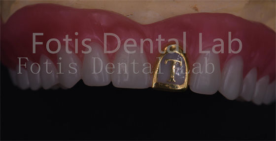 Dentadura natural de acrílico completo Ivoclar Dentes resistentes a las manchas