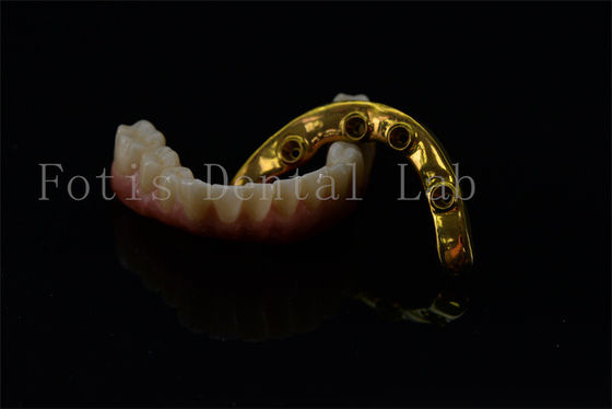 Circonio de titanio todo en 4 todo en 6 implantes de sonrisa completa implantes de garantía de por vida