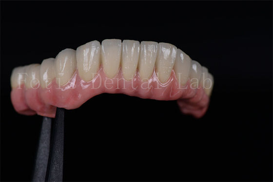 Alta tasa de éxito todos en cuatro todos en seis Circonia Titanio implantes dentales personalizados