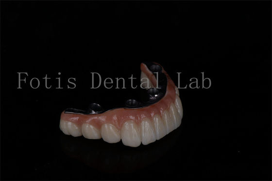 No hay límite de edad asequible todo en 6 implantes de zirconia fácil mantenimiento