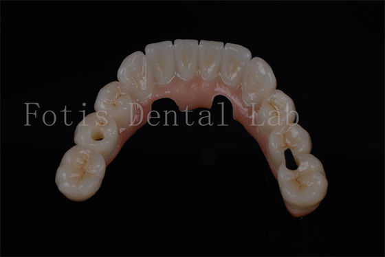 Un aspecto natural en cuatro dientes en un día para cualquier edad disponible