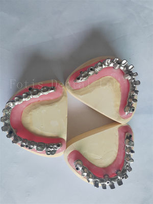Personalizado todo en 4 todo en 6 La solución perfecta para la restauración de implantes dentales