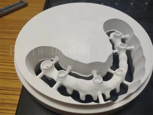 Implante dental pulido higiénico con corona de zirconia diseño personalizable