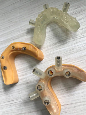 Coronas artificiales de dientes de alta resistencia para implantes sin igual y durabilidad