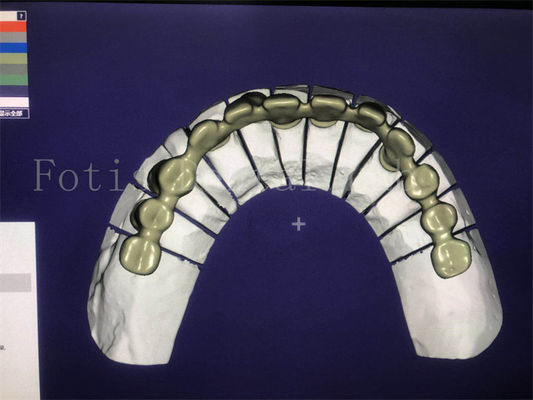 Servicio de diseño dental eficaz y confiable Superior y competitivo