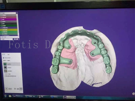Estudio de diseño de prótesis dentarias de restauración dental diseñado con habilidad para su satisfacción