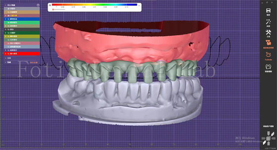 OEM Modelos de Boca Fabricante Servicio de Diseño Dental Con Constructor de Planos Dentarios