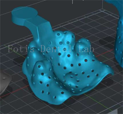 Servicio de diseño dental personalizable Programa de mejora del esmalte