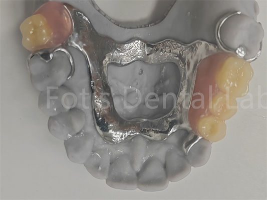 FDA Dentadura parcial extraíble fácil de limpiar compatible con dientes naturales