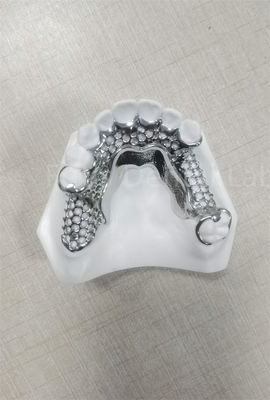 Alta estabilidad Dentes parciales flexibles Fácil limpieza Mantenimiento regular