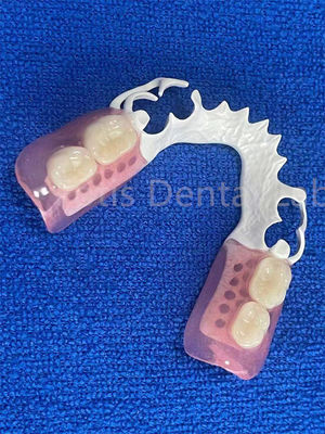 Prótesis dental ajustable flexible estable cómoda Dentadura parcial inmediata