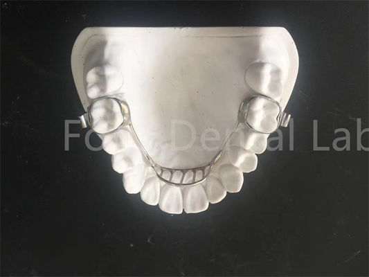 Retener de expansión personalizable Retener de expansión palatal Mantener de expansión fácil mantenimiento