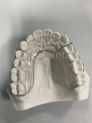 Solución de retención dental duradera y versátil