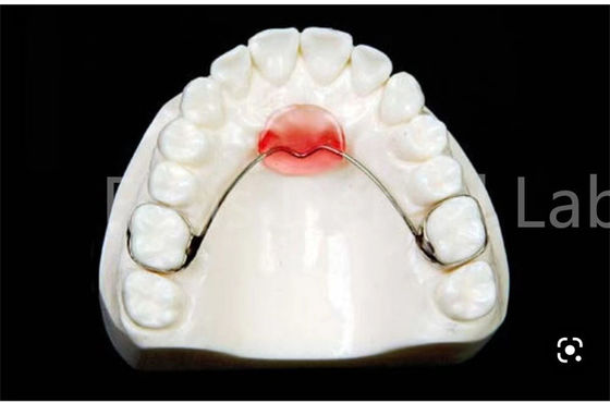 Retenor de expansión de la boca ajustable para la retención y expansión segura de los dientes