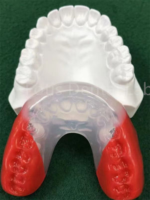 Aparatos ortodónticos de grado médico para alinear los dientes perfectamente