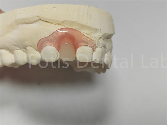 Parciales dentales de valspar rosa / transparente flexibles fácil ajuste
