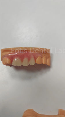 Durabilidad TCS Flexible Parcial Valplast Dentes flexibles Resistente a las manchas