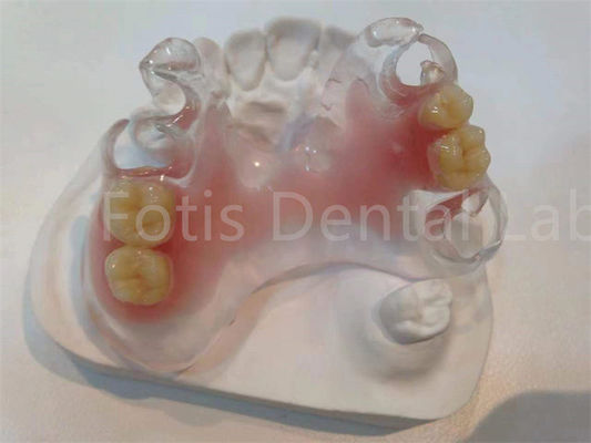 Prótesis dental TCS Valplast hipoalergénica resistente a manchas para una comodidad duradera