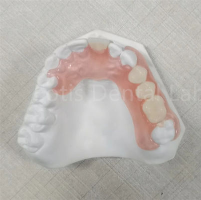 Prótesis dental flexible resistente a los olores y transparente