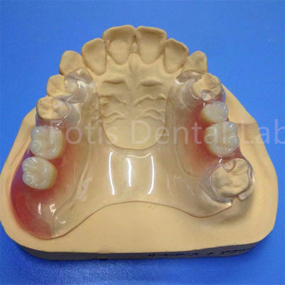 Fácil de limpiar y ajustar Prótesis dental parcial Durable Confortable